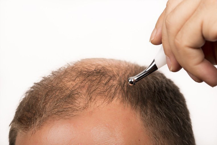 Микротоковая терапия для роста волос